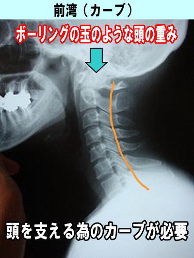 首の痛み　伊丹市　カイロ